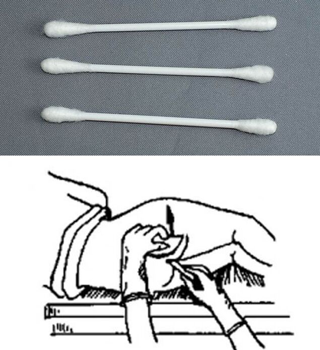 Analytické palice
