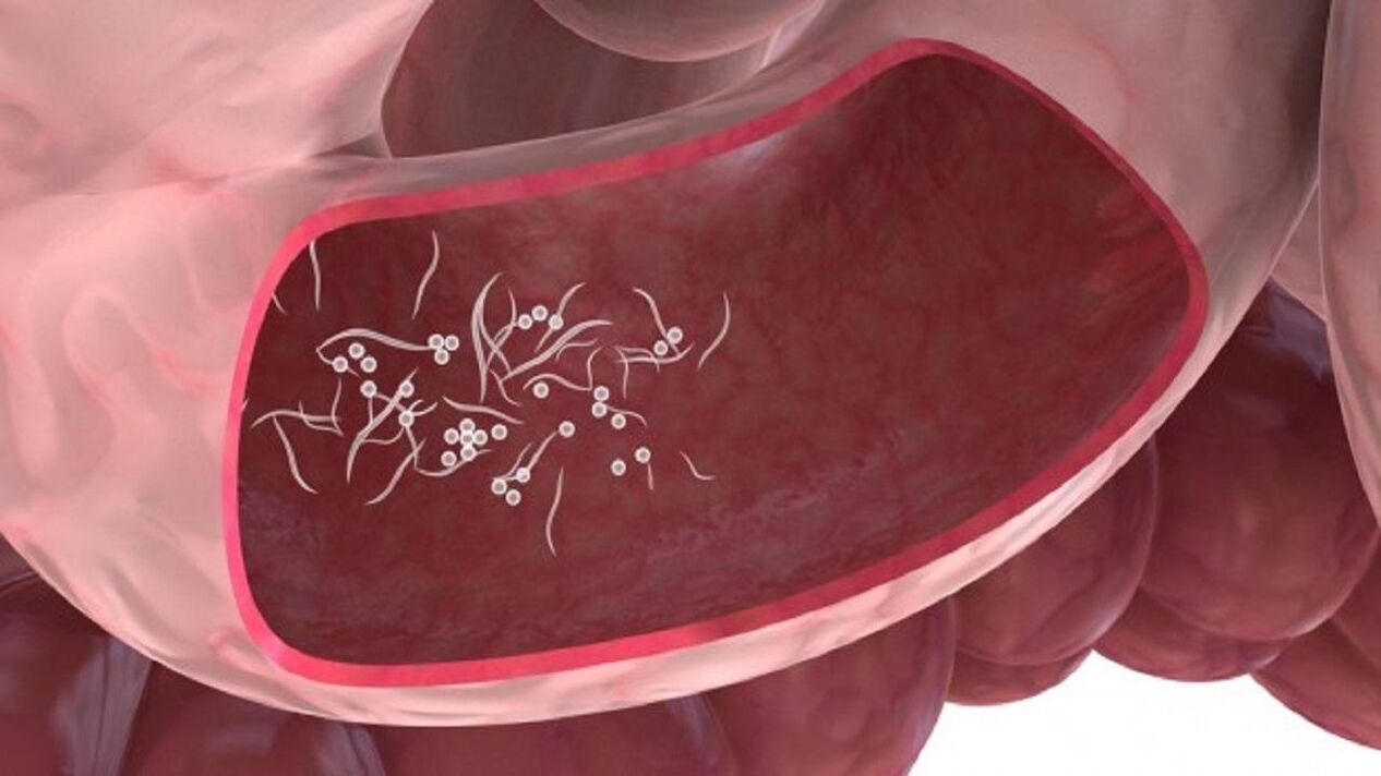 Giardia parazituje v pečeni