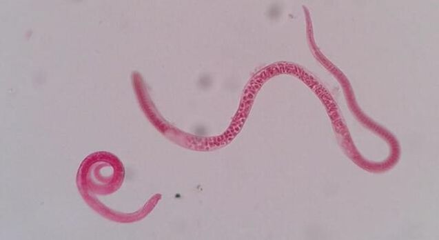 ako vyzerajú trichinely