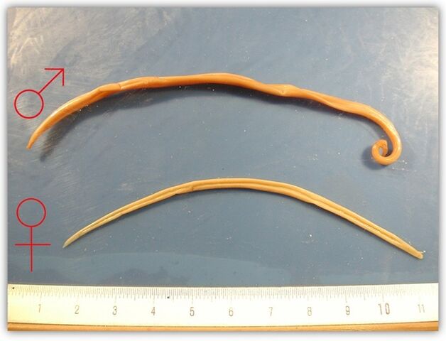 ako vyzerajú škrkavky