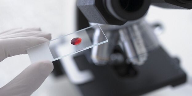 krvný test na diagnostiku parazitov v tele